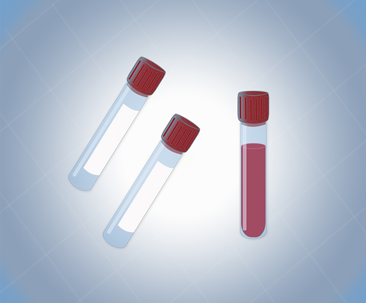 PSA-test-750×620